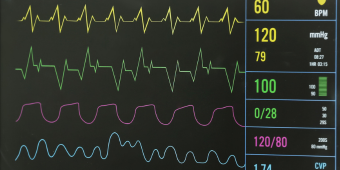 patient monitor